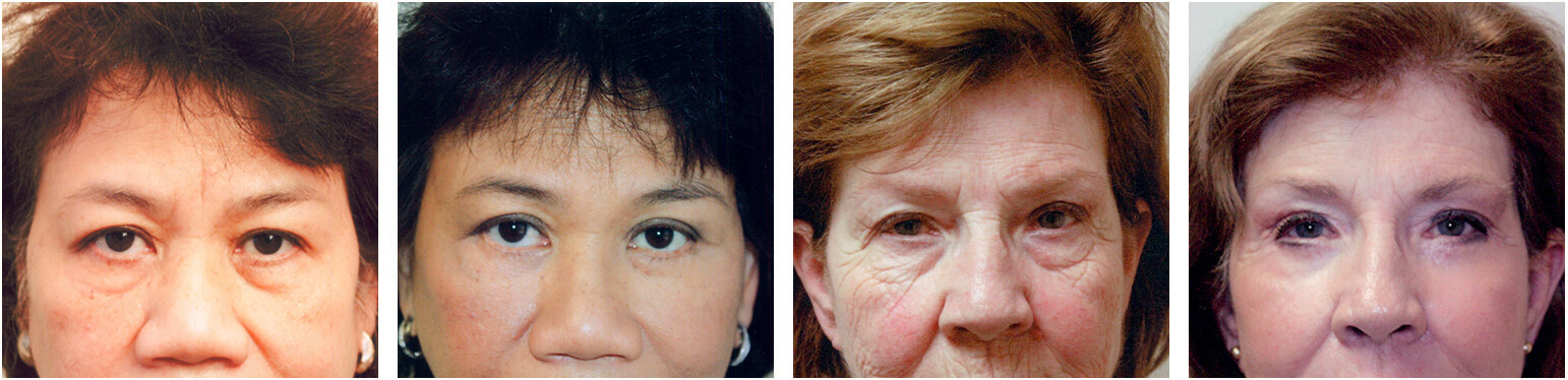 Patients Photos