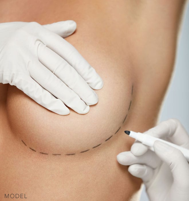 Incision location