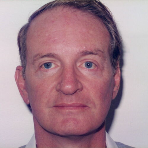 Male Facelift Patient 10 - After - 1