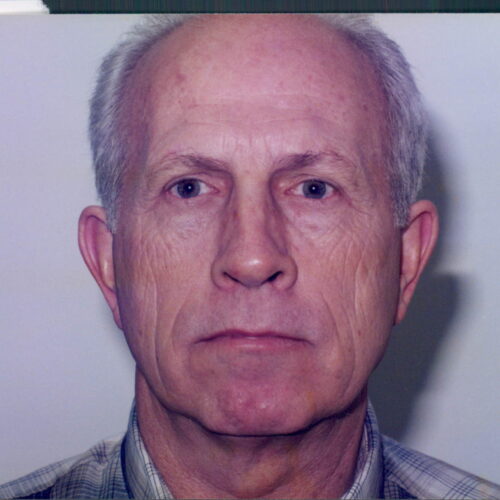 Male Facelift Patient 09 - Before - 1