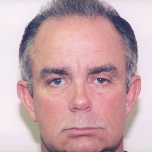 Male Facelift Patient 08 - Before - 1