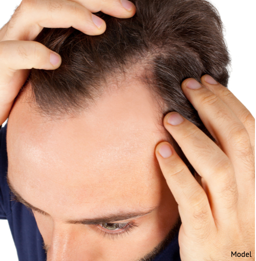  The majority of men experience hair loss, which may increase facelift incision visibility.