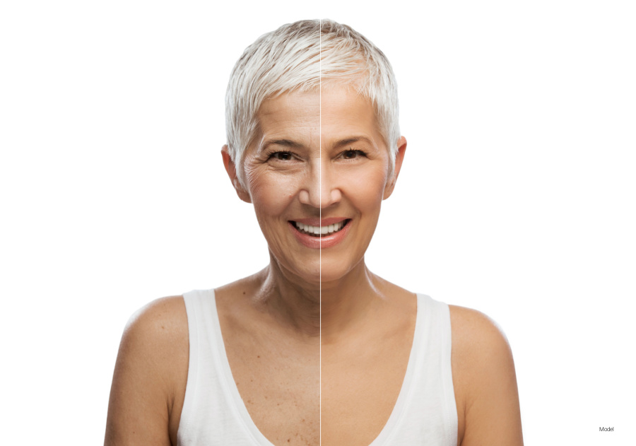 A beautiful older woman wearing white before and after facial rejuvenation.