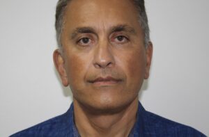 Male Facelift Patient 31 - After - 3 Thumbnail