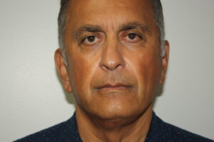 Male Facelift Patient 31 - Before - 3 Thumbnail