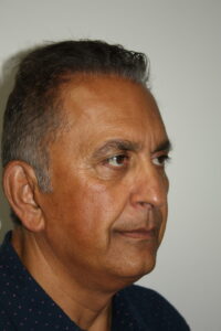 Male Facelift Patient 31 - Before - 1 Thumbnail