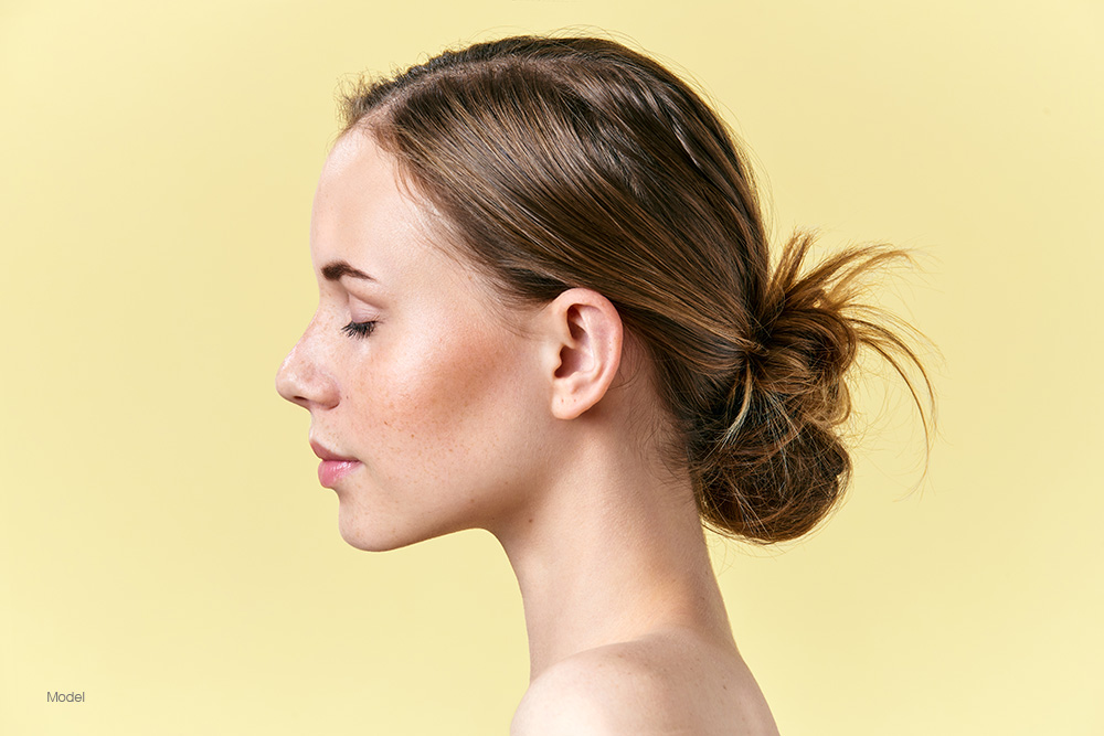 rhinoplasty post model
