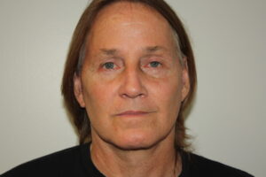 Male Facelift Patient 32 - After - 3 Thumbnail