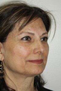 Female Facelift Patient 73 - Before - 1 Thumbnail