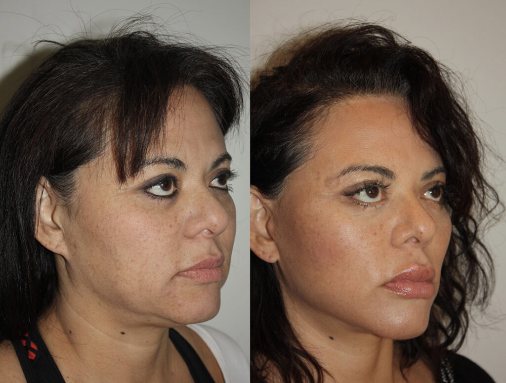 Actual patient results 4