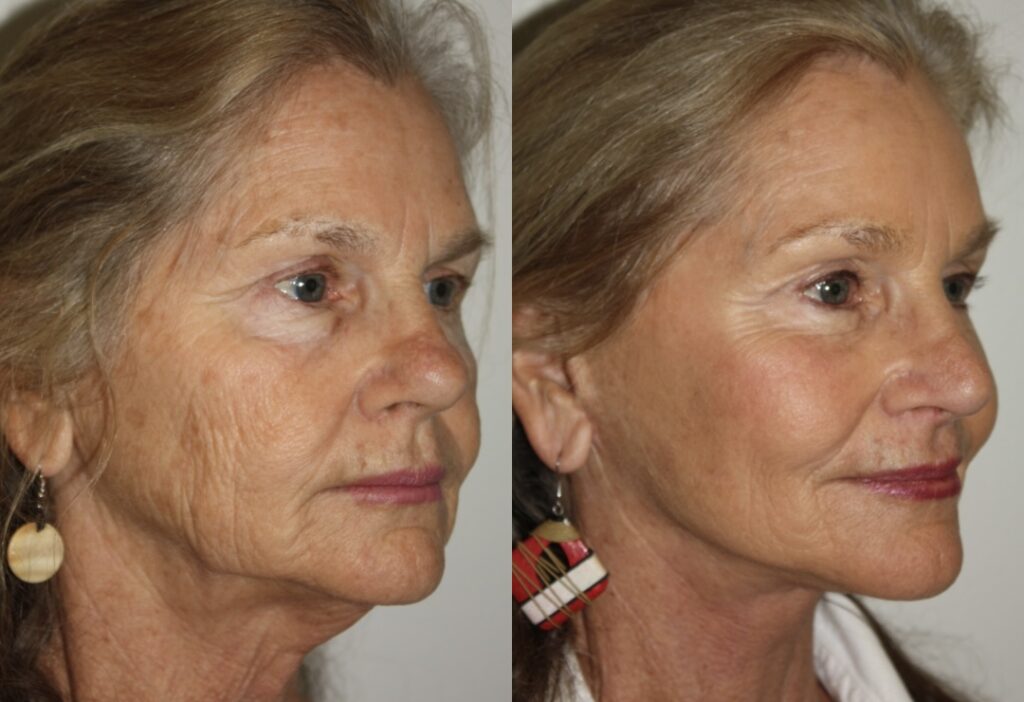 Actual patient results 2