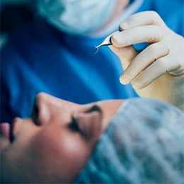 Dr Boris M Ackerman MD performing CO2 laser procedure on patient's face in medical setting - Eyelid surgery in Newport Beach, CA