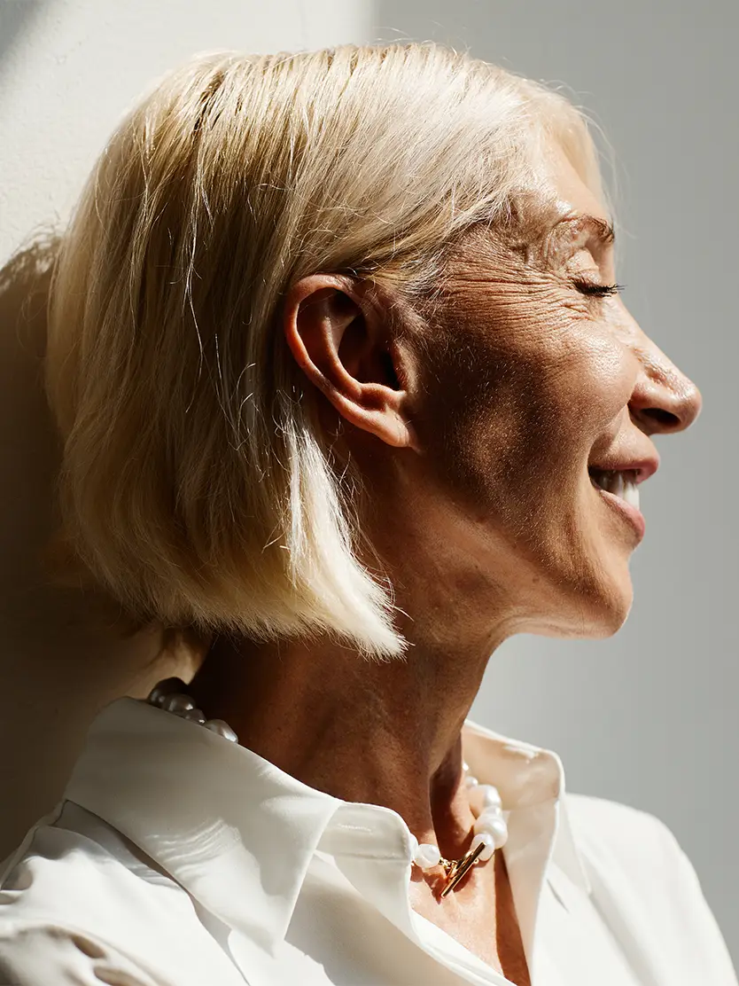 Real patient results in Newport Beach, CA Performed by Boris M. Ackerman MD